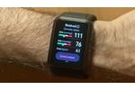 Huawei Watch D Blutdruckmesser Smartwatch